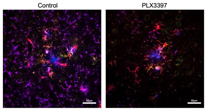 Neuron illustration accompanying ScienceAlert’s report on Alzheimer’s sleep disruption and microglia. - sciencealert.com