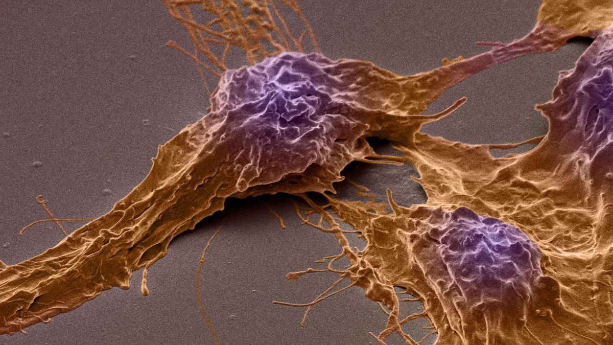 Scanning electron microscope image of human brain cancer stem cells. - Izzat Suffian, Pedro Costa, Stephen Pollard, David McCarthy and Khuloud T. Al-Jamal/Wellcome Collection, CC BY 4.0